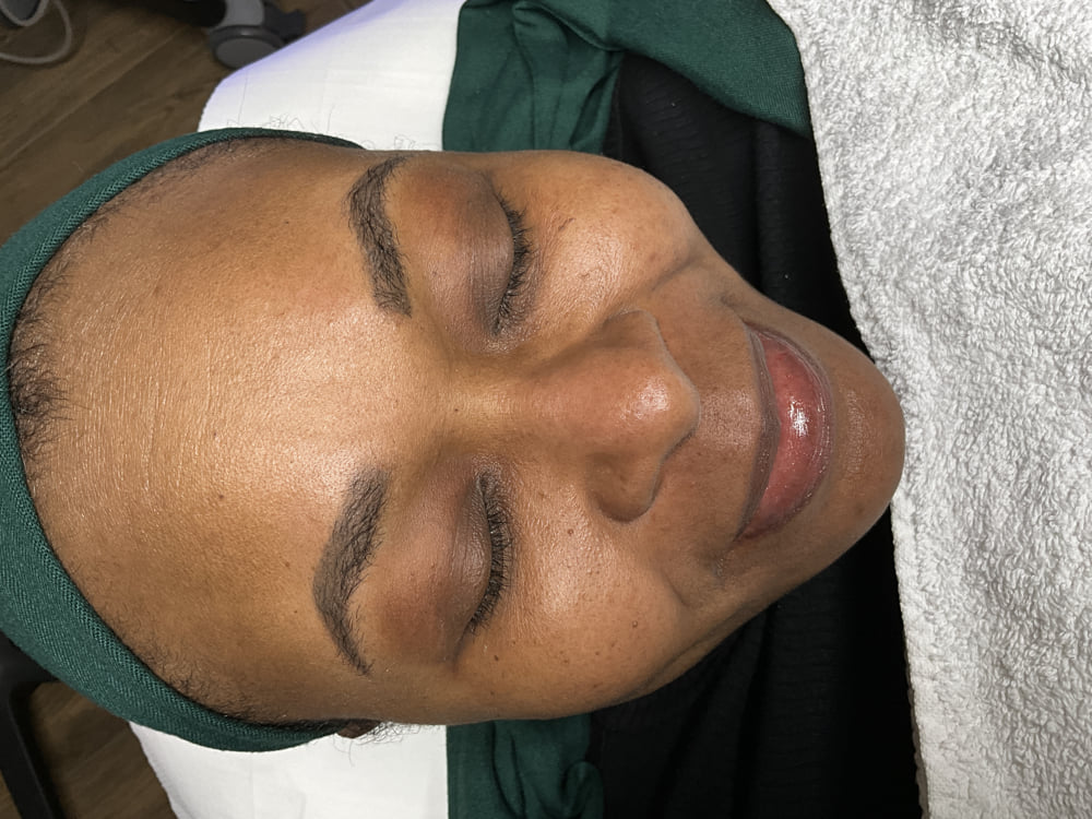 hydrafacial before