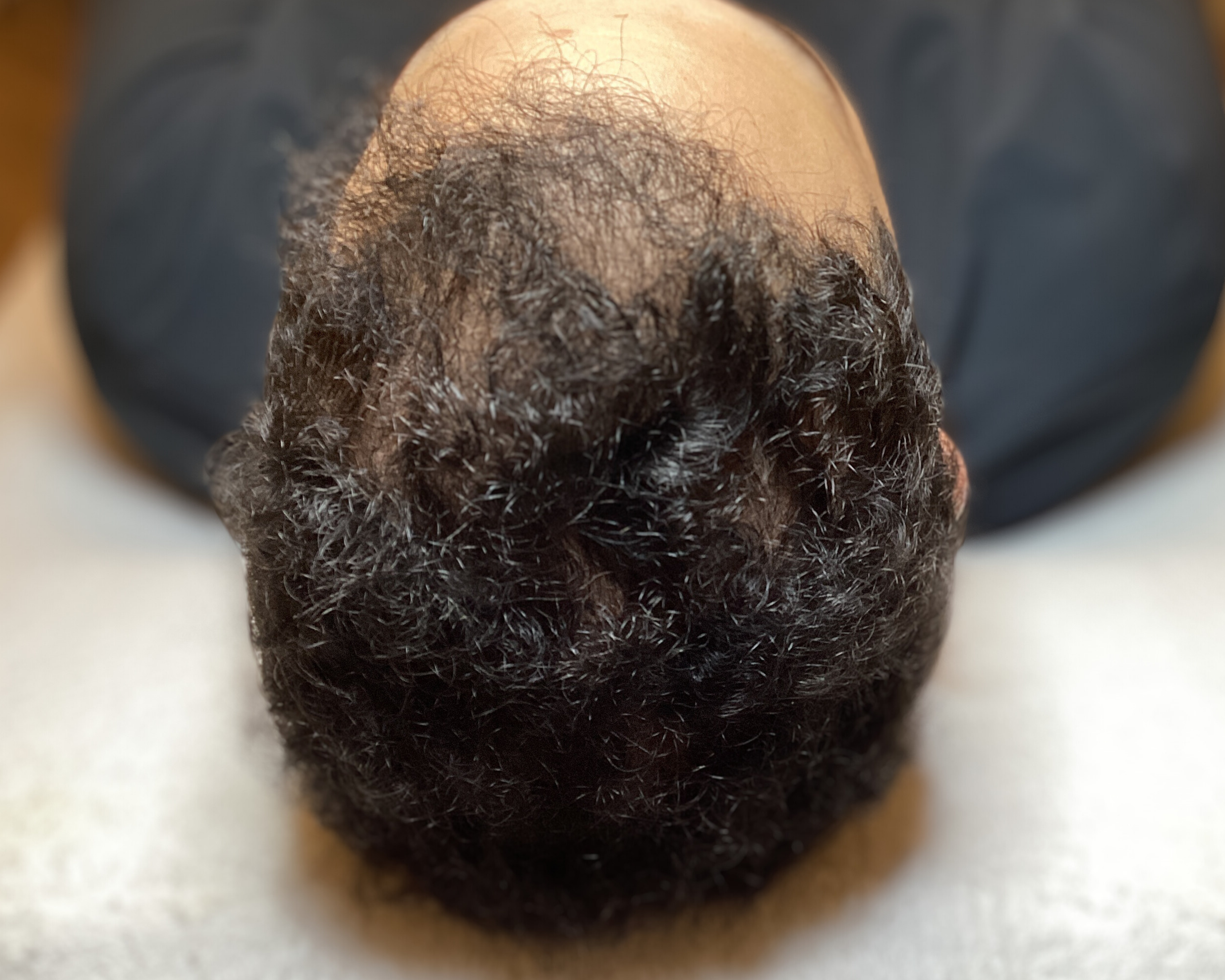 Hairbooster