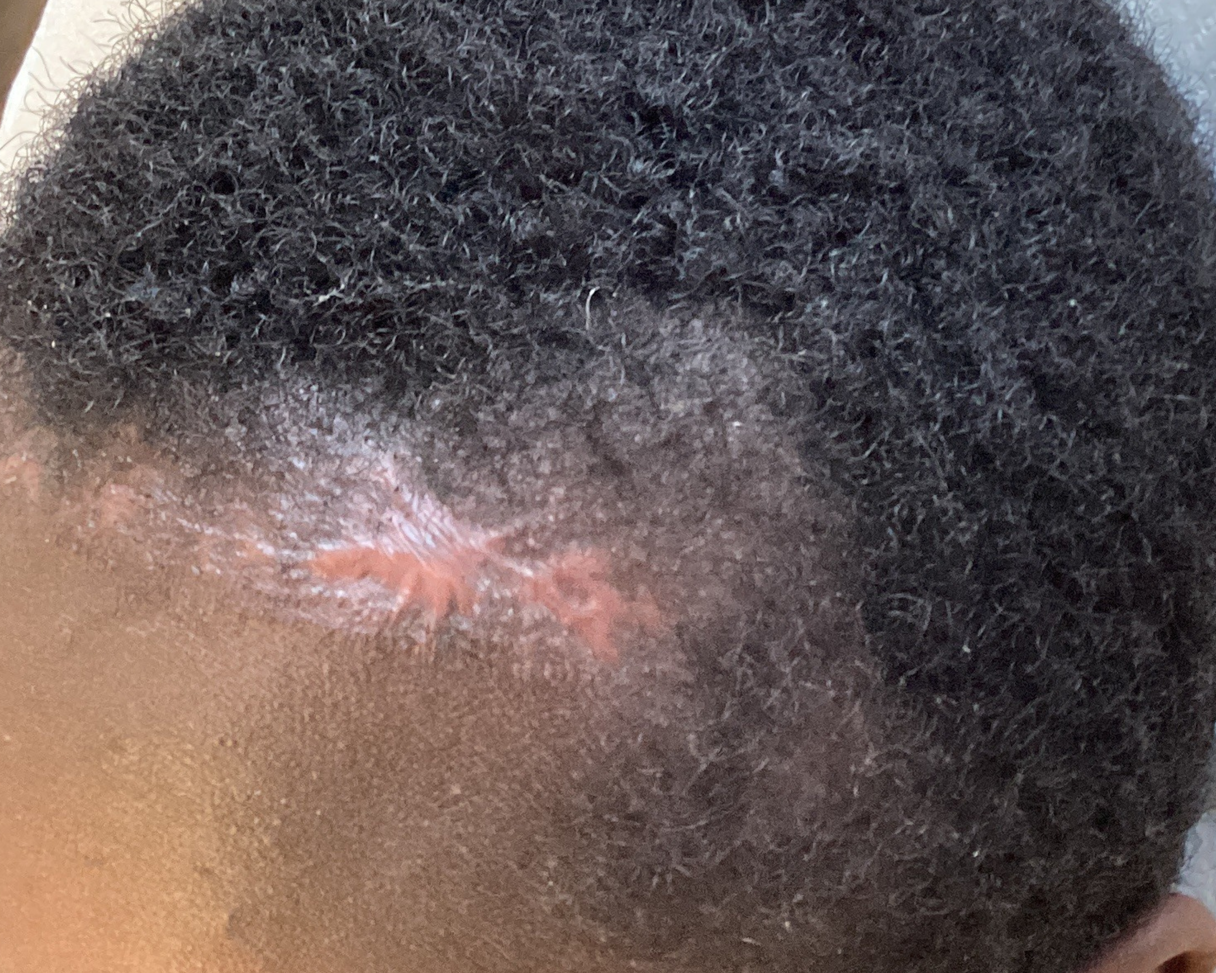 Hairbooster