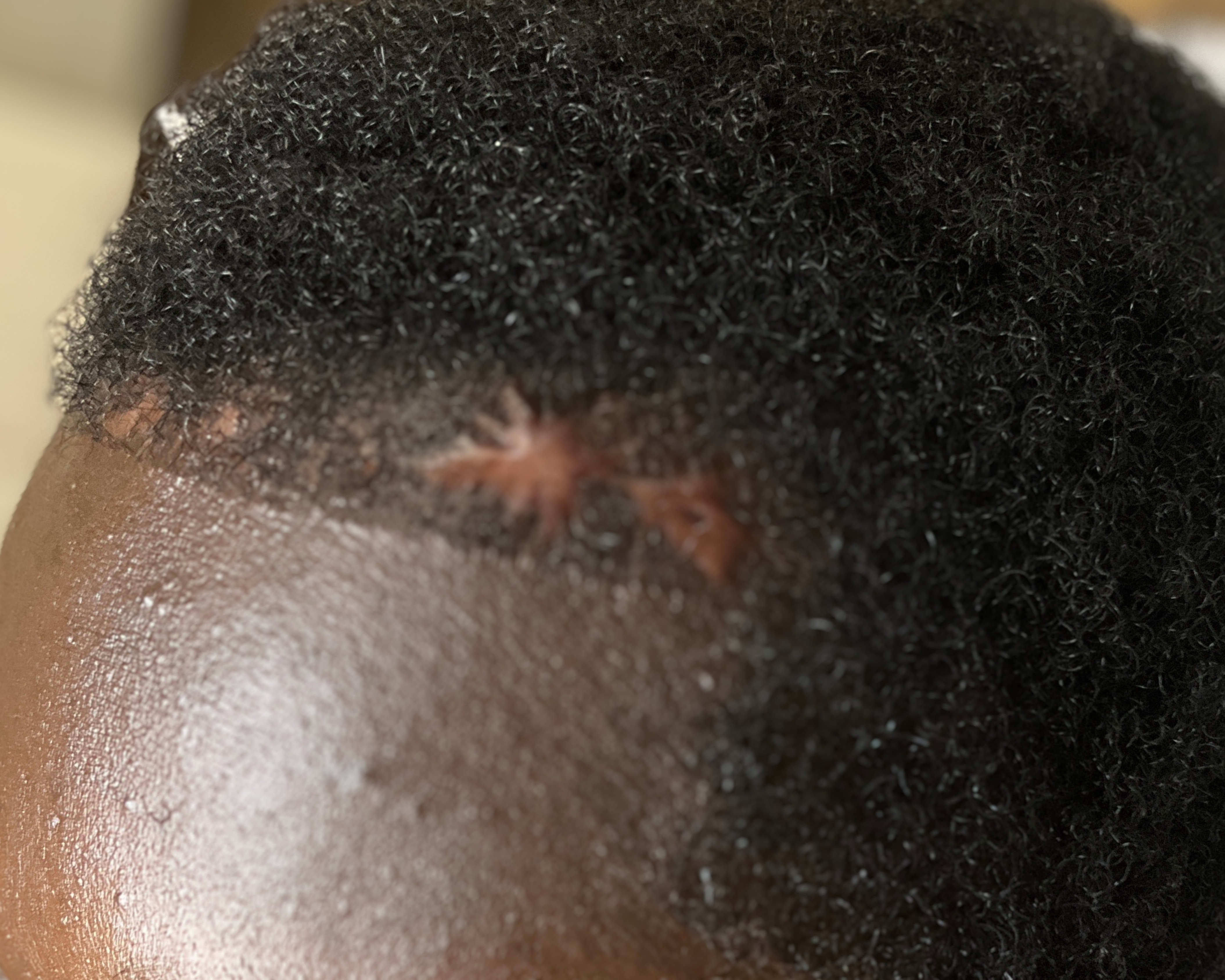 Hairbooster